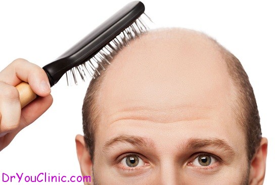 رژیم غذایی برای جلوگیری از ریزش موی مردان